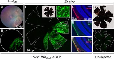 Simple Autofluorescence-Restrictive Sorting of eGFP+ RPE Cells Allows Reliable Assessment of Targeted Retinal Gene Therapy